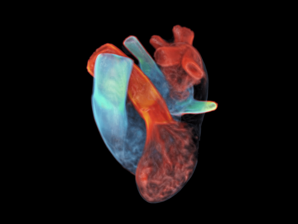 Siemens Healthineers uses datasets from MRI and EKG measurements to create a digital twin heart