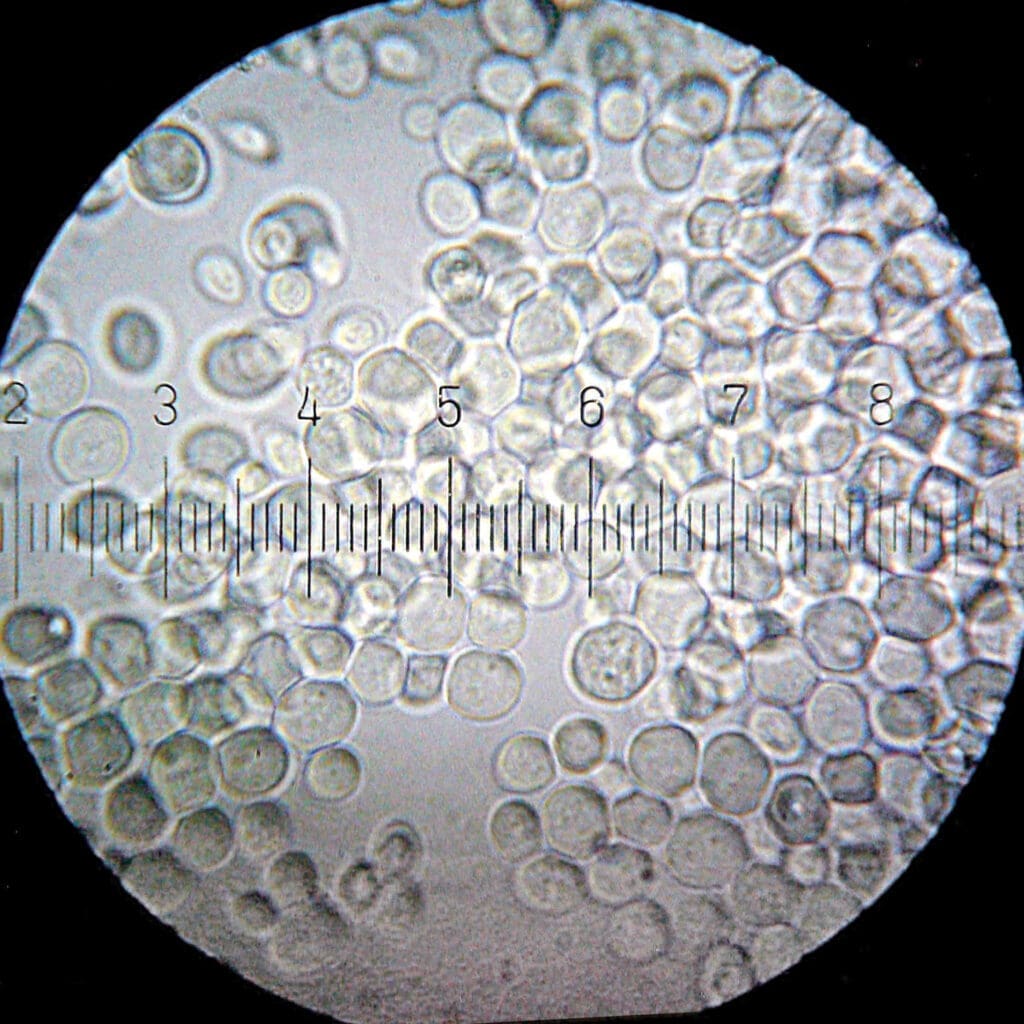 Backhefe "Saccharomyces Cerevisiae" unter dem Mikroskop; sie wird auch zum Bierbrauen verwendet